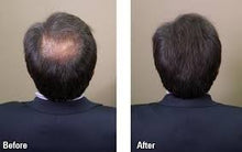 Load image into Gallery viewer, Toppik Hair Fiber 27.5g Black